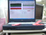 歯科用下顎測定装置