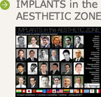 書籍 IMPLANTS in the AESTHETIC ZONEのご紹介