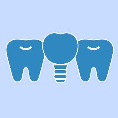 歯のメンテナンス