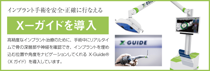 Xガイドを導入しました