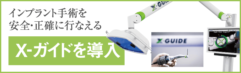 Xガイドを導入しました